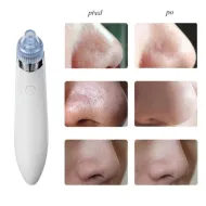 Vákuový čistič pleti - DermaSuction